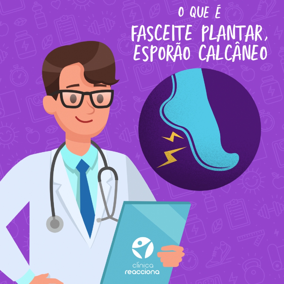 Fasceite Plantar, Esporão calcâneo